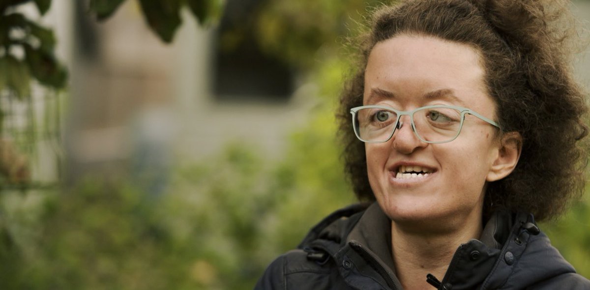 Dr Nicola Marie Stock (@nicolamarie) on Twitter photo The fourth film in the ACCORD series by <a href="/CAR_UWE/">Appearance Research</a> <a href="/HeadlinesCranio/">Headlines Craniofacial Support</a> <a href="/finerolling/">Fine Rolling Media</a> stars Zoe, who describes the #employment challenges she’s encountered and what needs to change to support people with #disabilities in the #workplace. headlines.org.uk/for-adults. #Craniofacial The fourth film in the ACCORD series by <a href="/CAR_UWE/">Appearance Research</a> <a href="/HeadlinesCranio/">Headlines Craniofacial Support</a> <a href="/finerolling/">Fine Rolling Media</a> stars Zoe, who describes the #employment challenges she’s encountered and what needs to change to support people with #disabilities in the #workplace. headlines.org.uk/for-adults. #Craniofacial