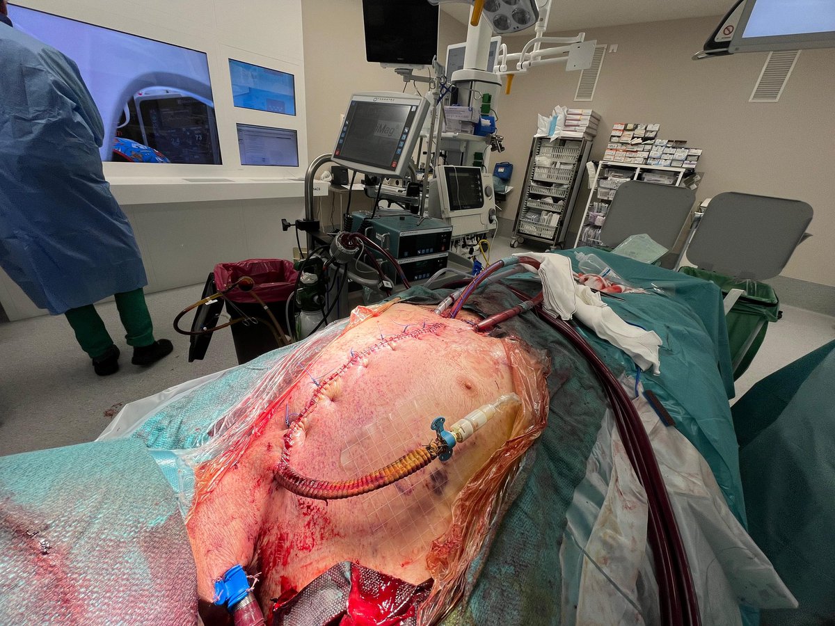 Cardiac Surgery Gregorio Marañon Hospital tweet media