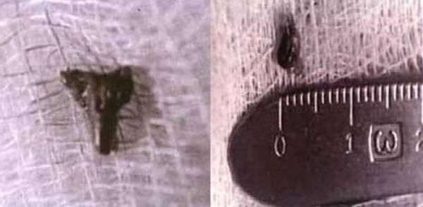 Juanman58705679's tweet image. 66.- El misterioso microchip “extraterrestre” que fue hallado en el cráneo de Napoleón Bonaparte.
Cuando en Julio de 1794, Napoleón Bonaparte tenía aproximadamente unos 25 años, estuvo desaparecido varios días, al regresar la única explicación que dio fue que había sido…