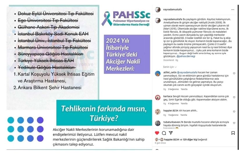 PAHSScDernegi's tweet photo. @_BurcuUgur_ @saglikbakanligi @drfahrettinkoca Maalesef durum çok vahim. Akciğer Nakli ekiplerinin kendi özverileri ile ayakta tutuluyordu. Yıllarca sahipsizdiler.  Ekipler tükendiler. Yetkililer yıllardır Akciğer nakline ilgisizler Dünyada Akciğer nakli bir prestijdir Çünkü en zor organ nakildir. Kartal Koşuyolu da kapanıyor https://t.co/URM7VYlN3z