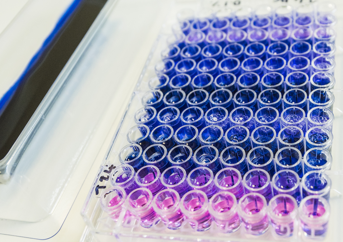 Manchester Cancer Research Centre (@mcrcnews) on Twitter photo π New research led by <a href="/DrKC_Njoku/">KC Njoku</a> & <a href="/ProfEmmaCrosbie/">Emma Crosbie</a> published in <a href="/eBioMedicine/">eBioMedicine β The Lancet Discovery Science</a>, reports a simple, safe and 95% accurate test that identifies post-menopausal women with womb cancer.
Read more: mcrc.manchester.ac.uk/kinder-test-coβ¦
<a href="/MFT_research/">MFT Research and Innovation</a> | <a href="/FBMH_UoM/">UoM Biology, Medicine and Health</a> | <a href="/CRUKResearch/">Science and Innovation at Cancer Research UK</a> π New research led by <a href="/DrKC_Njoku/">KC Njoku</a> & <a href="/ProfEmmaCrosbie/">Emma Crosbie</a> published in <a href="/eBioMedicine/">eBioMedicine β The Lancet Discovery Science</a>, reports a simple, safe and 95% accurate test that identifies post-menopausal women with womb cancer.
Read more: mcrc.manchester.ac.uk/kinder-test-coβ¦
<a href="/MFT_research/">MFT Research and Innovation</a> | <a href="/FBMH_UoM/">UoM Biology, Medicine and Health</a> | <a href="/CRUKResearch/">Science and Innovation at Cancer Research UK</a>