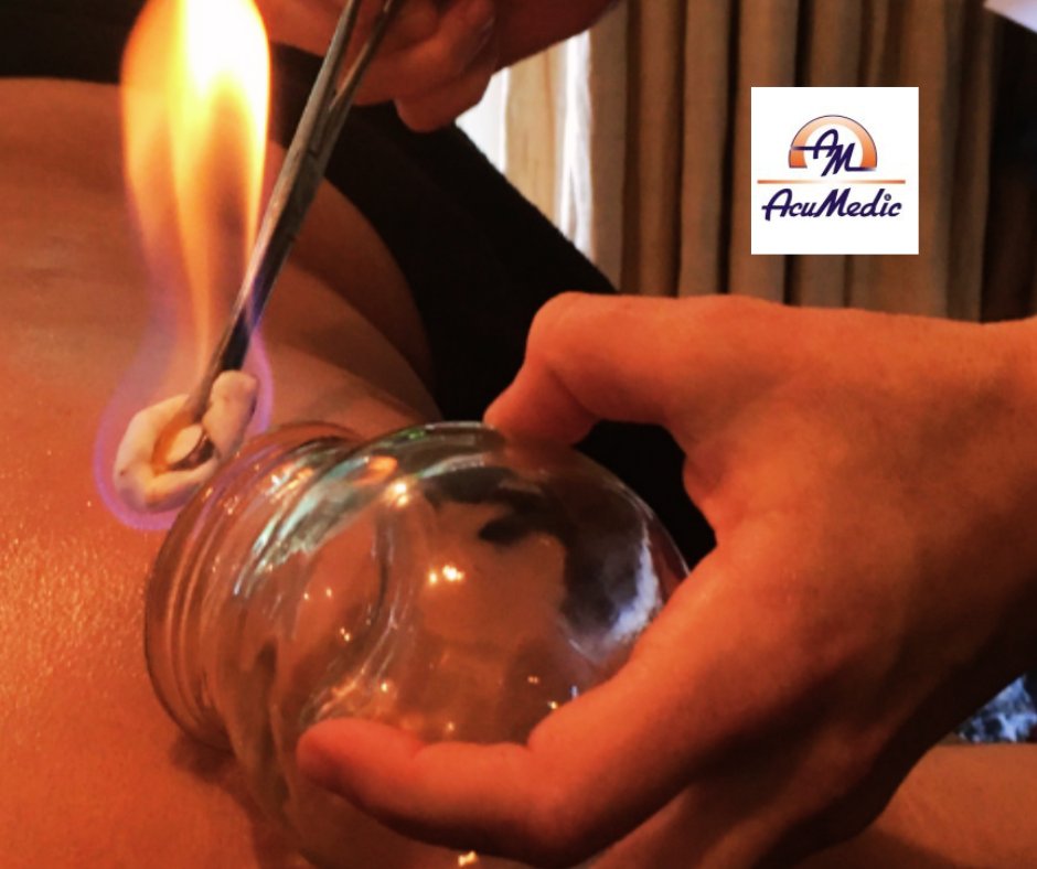 AcuMedic_Pro's tweet image. Learn the knowledge and skills to perform Chinese Fire #Cupping with glass cups in this 1-day course.

Unlike many other UK courses, this one will teach you authentic techniques used in real Chinese clinics.

21 April at AcuMedic in London. 

Book today:

shop.acumedic.com/product/amf-cu…