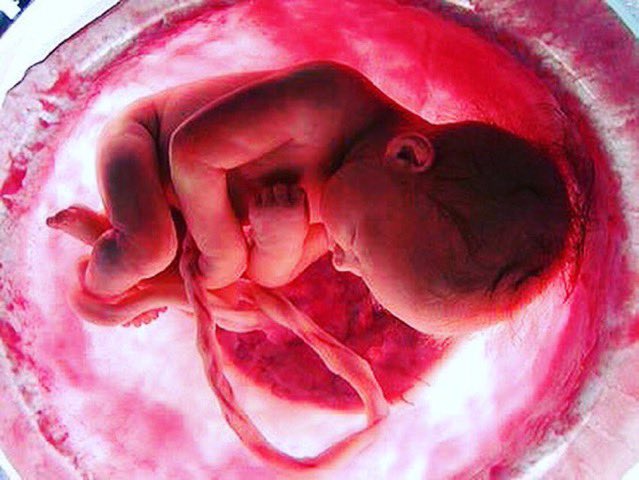 Nada puede cambiar el hecho de que mediante el #aborto se mata a un ser humano. #SiALaVida