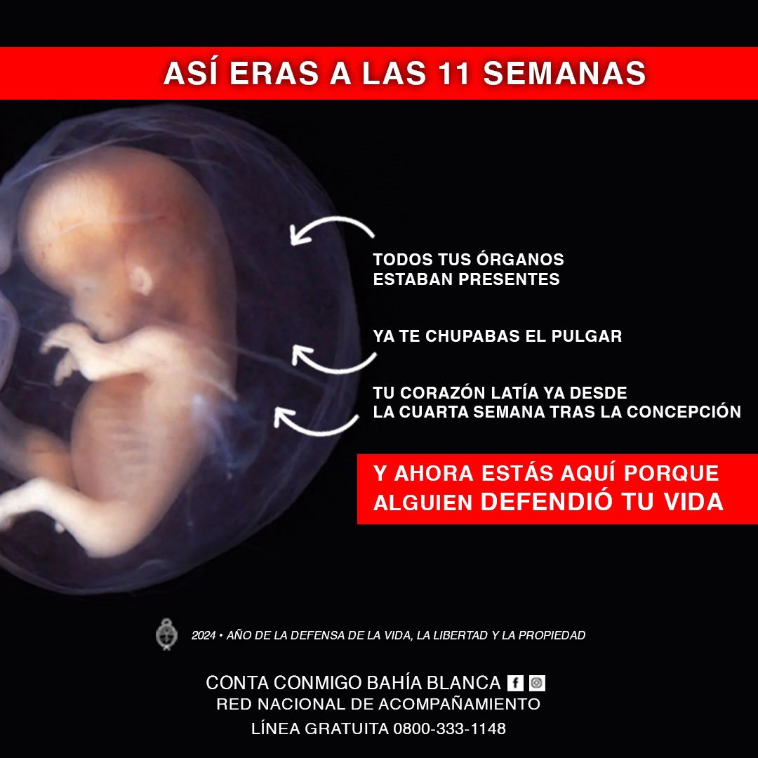 CaspeLiliana's tweet photo. Sí a la #vida siempre
#25demarzodiadelniñopornacer #contaconmigo
@Evelynr07780155 @FrenteJovenAR @DanteGebelOk @dlTorrePablo @danydipaolo @CynthiaHotton @AnaBelenMarmora @nadiajmarquez @BalleriniOK https://t.co/9hKjOSIINM
