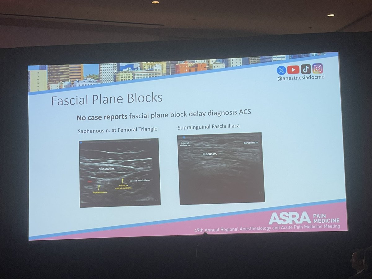 Excellent talk by @anesthesiadocmd: Does RA mask compartment syndrome?  Does not seem as such; best to avoid epidurals and IVRA, but other blocks are likely to be safe; keep open dialog and be on the lookout #ASRASPRING24