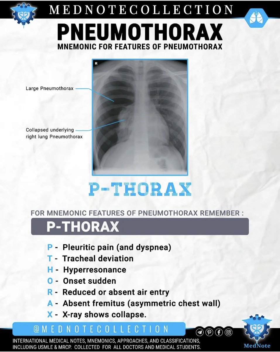 PNEUMOTHORAX 🫁 MNEMONIC FOR FEATURES OF PNEUMOTHORAX :🤓 ( P-THORAX ) #FOAMed #MedEd #MedTwitter #medicalstudent #medicalpractis #Cardiology #Emergency #emergencymedicine #medicaleducation #radiology #CXR