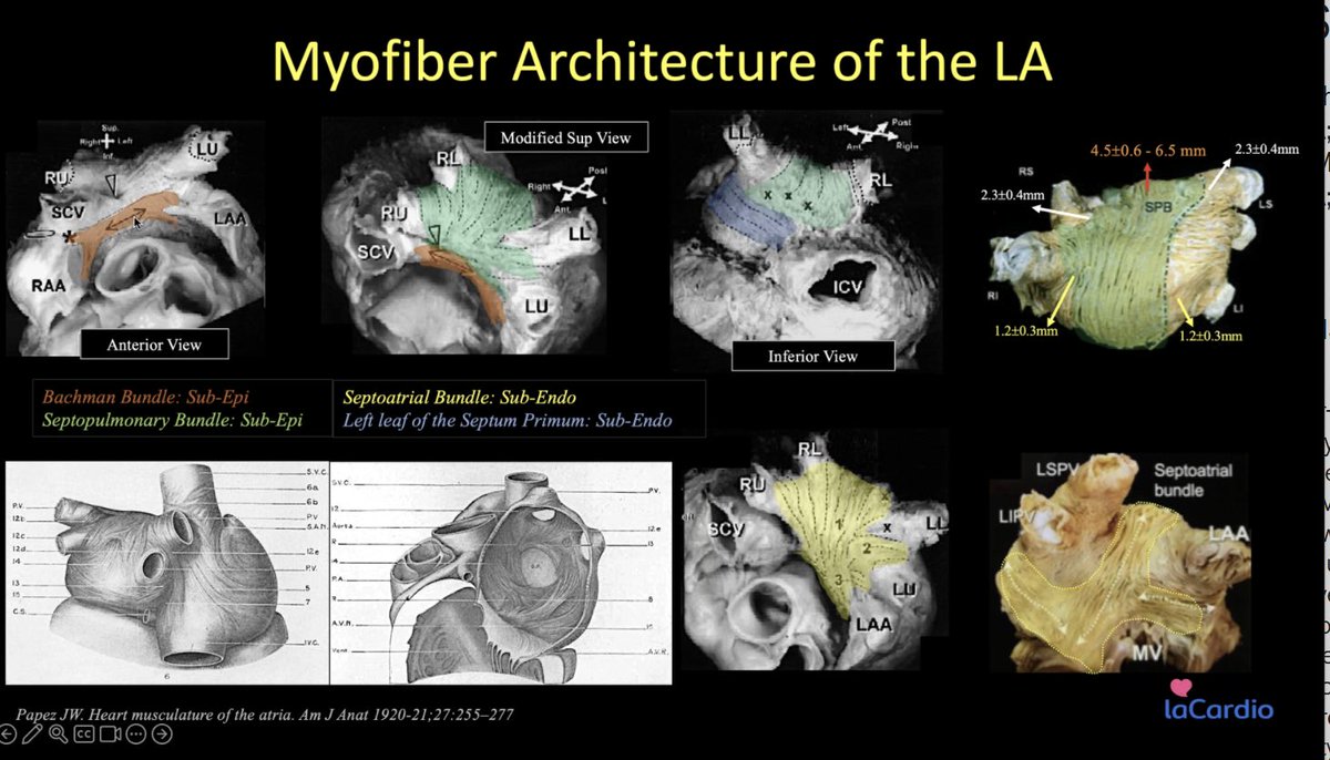 Arquitectura miofibrilar auricular Dr. @drluissaenz I summit de arritmias cardíacas complejas
