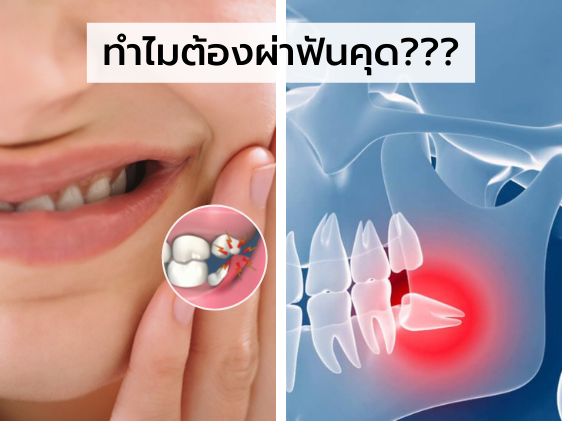 ลินไทยเปย์✨ tweet media