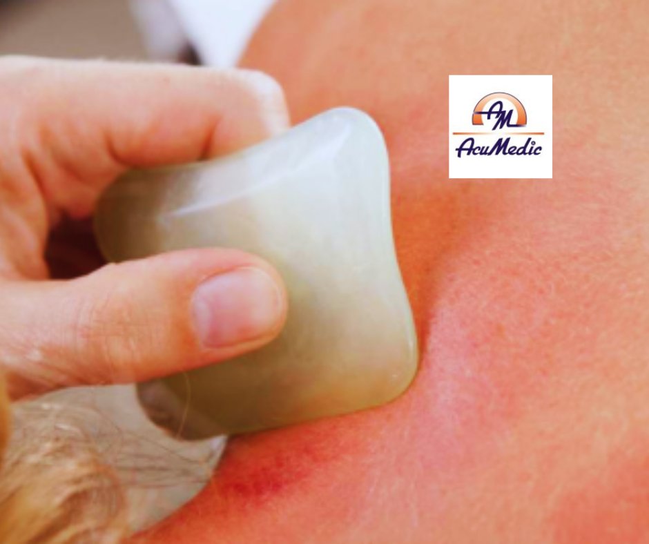AcuMedic_Pro's tweet image. Get the genuine Gua Sha skills in this unique training course,

Unlike many UK courses, we show authentic techniques as used in real Chinese clinics using traditional tools - so you can give your clients the best results.

20 April at AcuMedic.

Book now:

shop.acumedic.com/product/amf-gu…