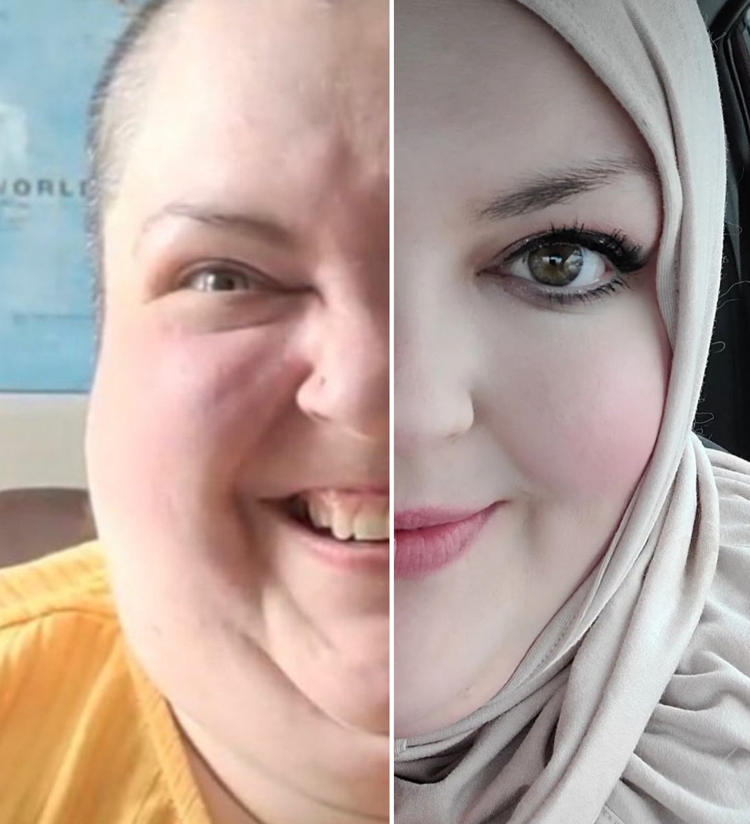 When is the Furburger not %100?!?!
Except lately, even the hijab & filters aren't doing much for them super CornFed Cornt Jethro jowls & gross wet baby bird skin eyelids..
That's all yours Salah! 

#FlapsMcNasty #FoodieBeauty #EverydayMariam #MichealFurburger
#SalahTwerks