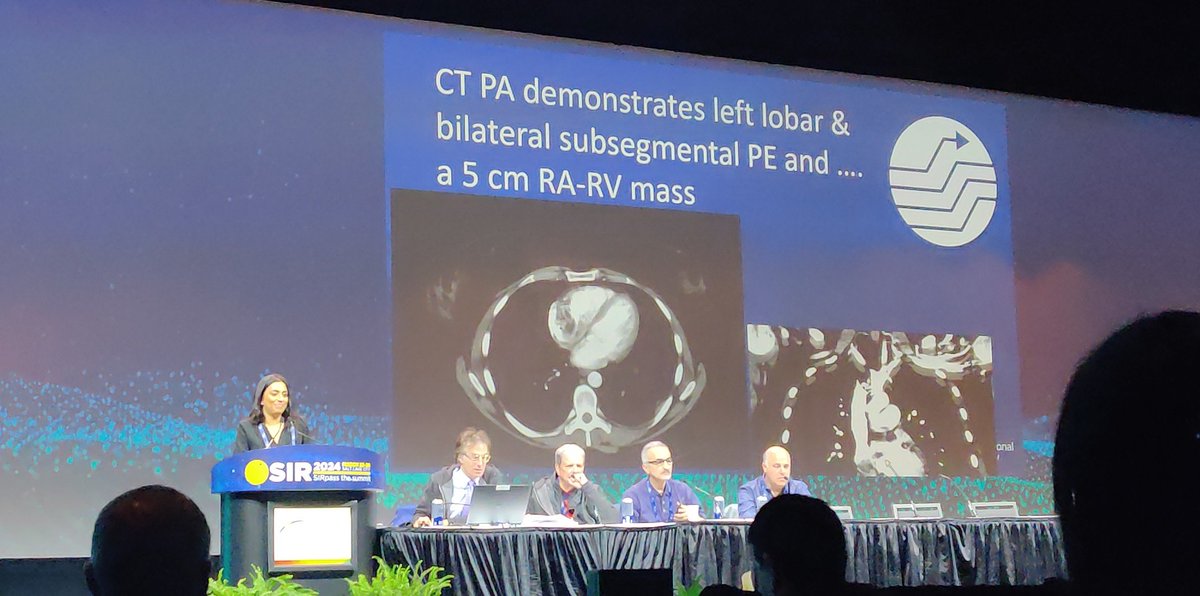 @msran124 from @uclaVIR presents her #ExtremeIR case at #SIR24SLC. Awesome complex case.