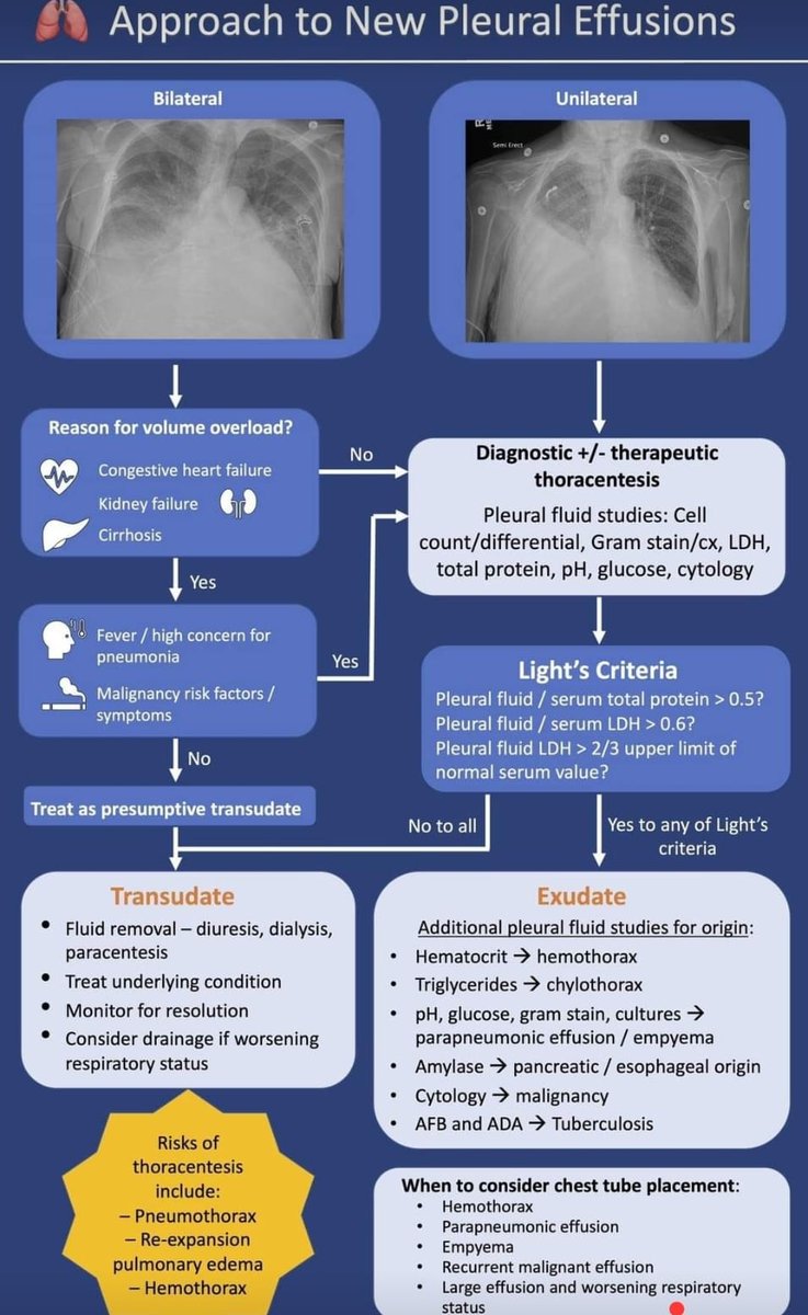 💧🫁 Pleural effusion Exudative vs Transudative Subscribe to our channel for more regular updates🔔👇 youtube.com/@pgmedicine2023
