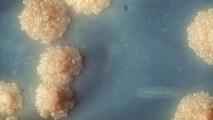 Instituto de Salud Carlos III (ISCIII) tweet media