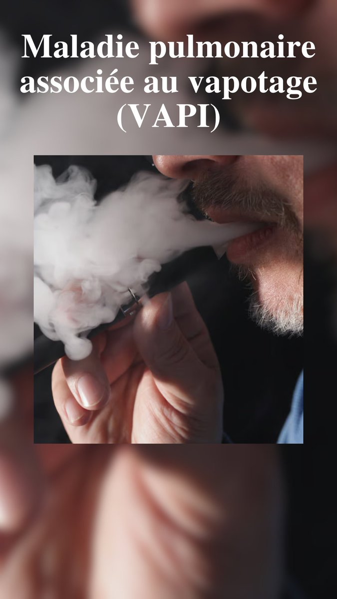 DrJabrane's tweet photo. Maladie pulmonaire associée au vapotage (VAPI)
https://t.co/K3yOspiaMb https://t.co/tfk2qzDEW4