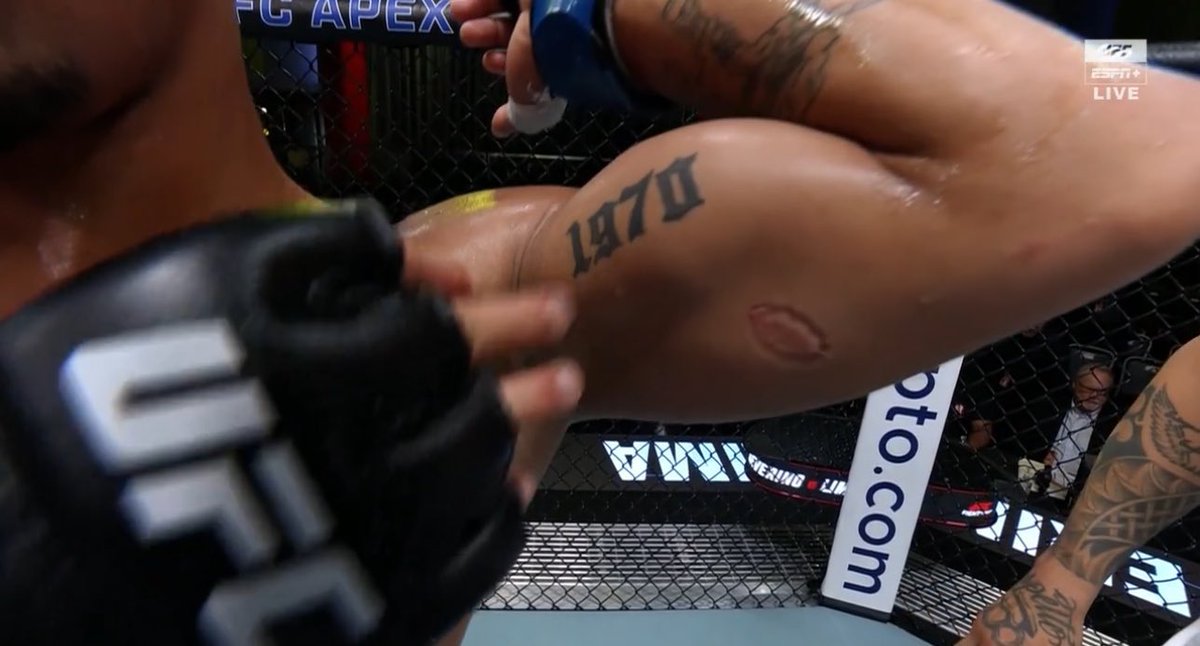 ThePoloGroundz's tweet photo. #Bitegate  #UFCVegas89 https://t.co/9IpffI9pgO