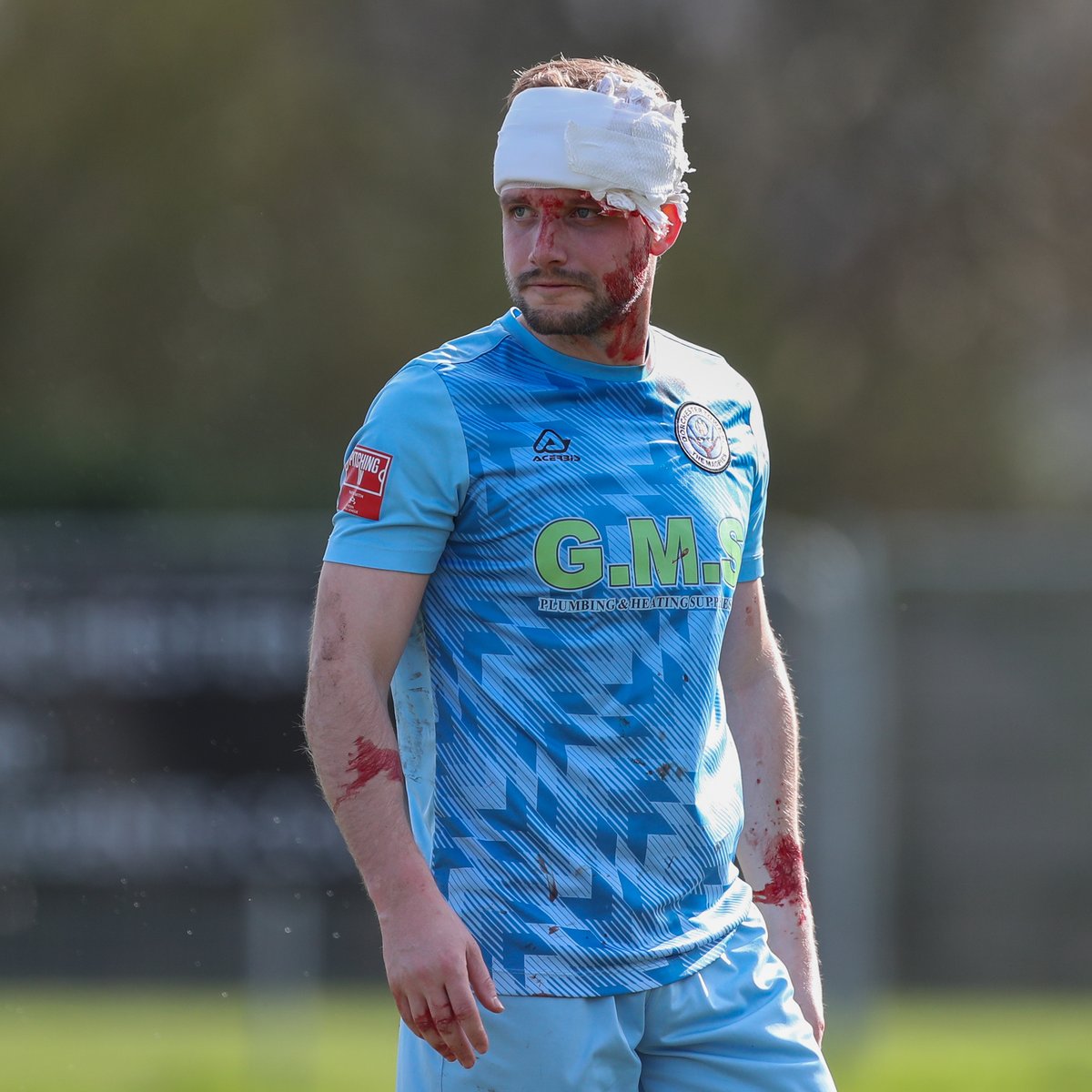 Neil Walton (@nwsportsjourno) on Twitter photo This is the damage done to <a href="/DorchTownFC/">Dorchester Town FC</a> midfielder <a href="/CMooro/">Corby Moore</a> at Winchester yesterday.
Up to 30 stitches required. Magpies dumbfounded by yellow card.
Deep wound for Moore ahead of his wedding this summer. Speedy recovery, Corby!
📸 <a href="/philstandfield1/">phillip standfield</a> This is the damage done to <a href="/DorchTownFC/">Dorchester Town FC</a> midfielder <a href="/CMooro/">Corby Moore</a> at Winchester yesterday.
Up to 30 stitches required. Magpies dumbfounded by yellow card.
Deep wound for Moore ahead of his wedding this summer. Speedy recovery, Corby!
📸 <a href="/philstandfield1/">phillip standfield</a>