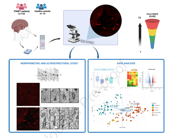 sociedadSEEN's tweet image. 🔝Primary cilia as a tumor marker in pituitary neuroendocrine tumors

👉 La ciliogénesis aumenta en los #PitNET, lo que sugiere que este proceso podría usarse como un objetivo potencial para la terapia en el futuro

linkinghub.elsevier.com/retrieve/pii/S…

@NeuroendocrinoS