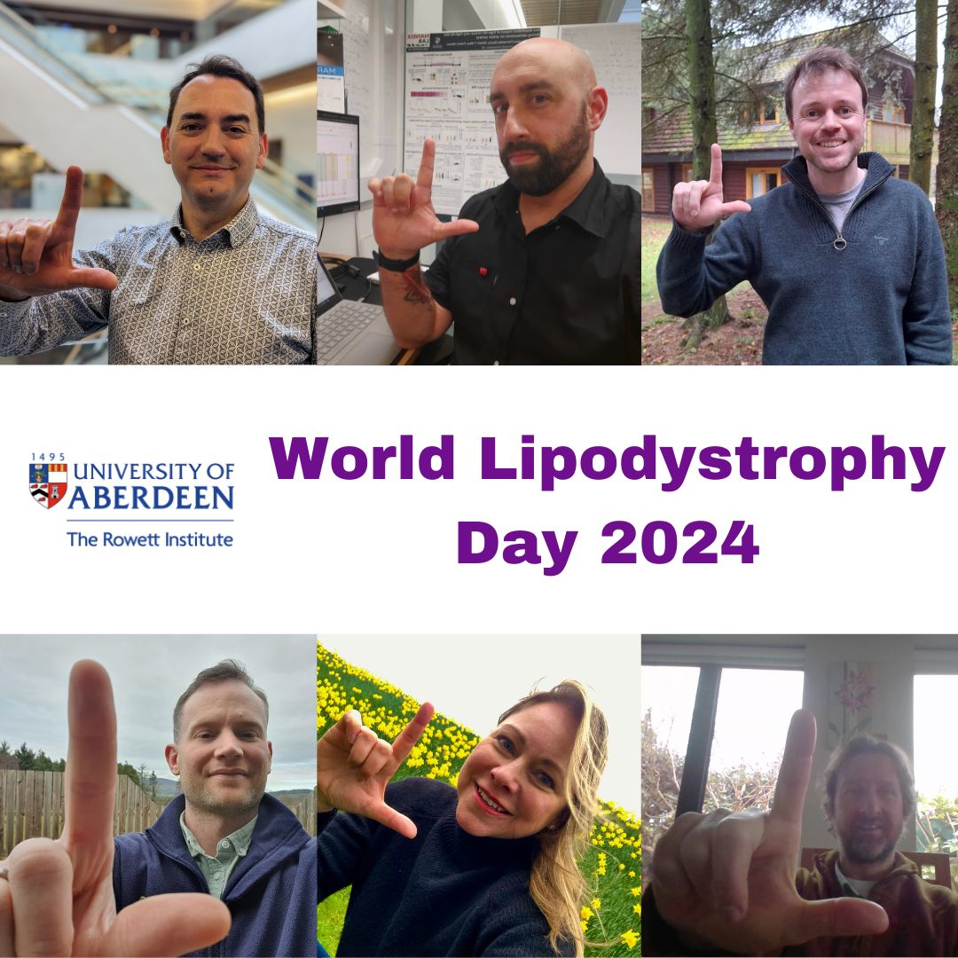 Rowett Institute (@rowett_abdn) on Twitter photo Today is World Lipodystrophy Day! Researchers in the labs of @rochfordJJ, @FabNaneix, George Mcilroy, <a href="/DrBMGabriel/">Brendan Gabriel</a> @loraheisler & <a href="/julesgrif/">Jules Griffin</a> are collaborating to define molecular mechanisms of disease in #Lipodystrophy and discover new therapies #WLD2024 @lipodystrophyUK Today is World Lipodystrophy Day! Researchers in the labs of @rochfordJJ, @FabNaneix, George Mcilroy, <a href="/DrBMGabriel/">Brendan Gabriel</a> @loraheisler & <a href="/julesgrif/">Jules Griffin</a> are collaborating to define molecular mechanisms of disease in #Lipodystrophy and discover new therapies #WLD2024 @lipodystrophyUK