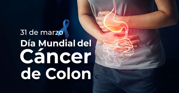 31 de Marzo 2024
#DíaMundialdelCáncerdeCólon
