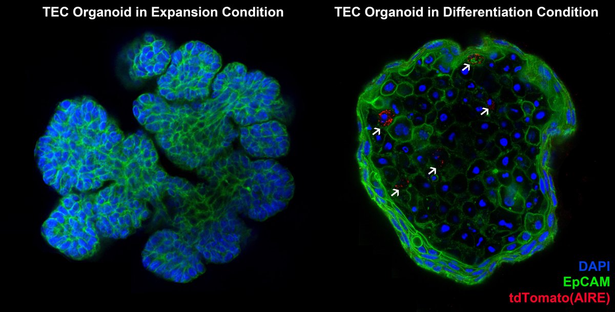 Hans Clevers (@hansclevers) on Twitter photo Sangho Lim and collaborators report mouse #thymus #organoid lines that can be expanded for years, represent cortex and medulla and sustain T cell development in vitro and in vivo. <a href="/TheCleversLab/">The Clevers Lab</a> cell.com/cell-reports/f… Sangho Lim and collaborators report mouse #thymus #organoid lines that can be expanded for years, represent cortex and medulla and sustain T cell development in vitro and in vivo. <a href="/TheCleversLab/">The Clevers Lab</a> cell.com/cell-reports/f…