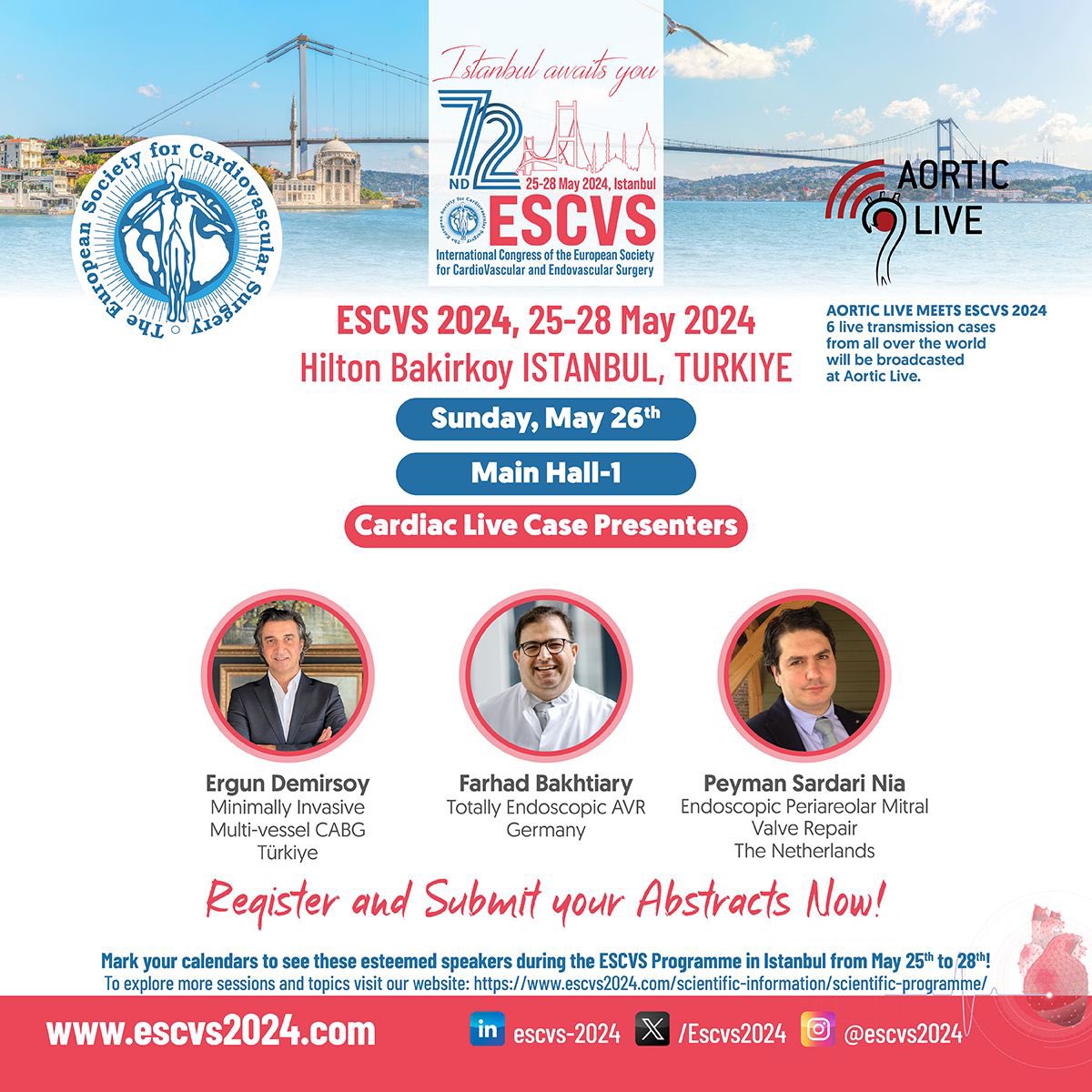 Thrilled to share our #heartteam will perform live #endoscopic #mitralvalverepair at ESCVS 2024! 🎥 Also featuring #minimallyinvasive CABG by Ergun Demirsoy’s team & endoscopic AVR by Farhad Bakhtiary’s team. Full details & registration on the ESCVS website! #cardiacsurgery