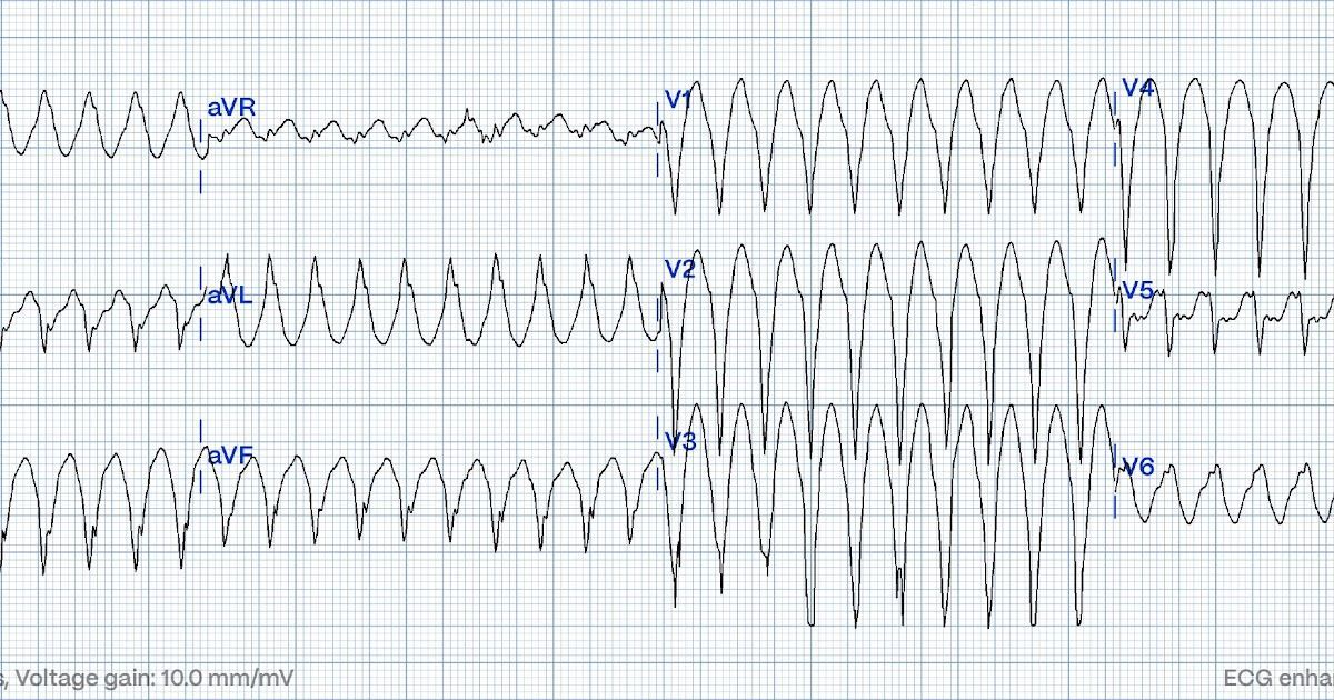 MRCEM Success tweet media