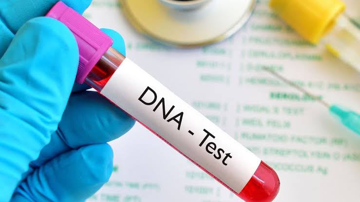 Should DNA 🧬 test be conducted immediately after child birth? 

What’s your take on this ? 

Retweet