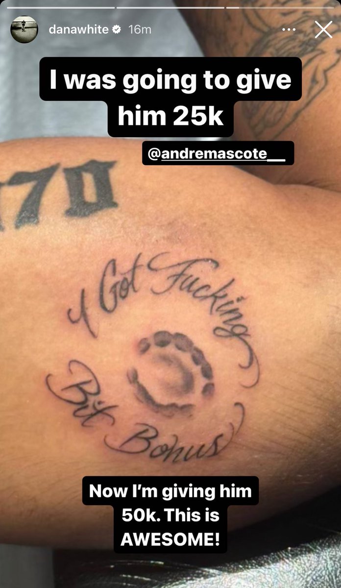 A wild turn of events gets commemorated 😂😂😂 …Lima already went and got a tattoo of the bite!