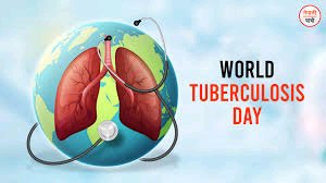Zimbabwe will today join the rest of the world in commemorating the World Tuberculosis Day.

The theme of World TB Day 2024 - 'Yes! We can end TB!'.
<a href="/dereckgoto/">Dereck Goto</a> <a href="/VulindlelaNdab2/">Vulindlela Ndabandaba</a> <a href="/ProfJNMoyo/">Prof Jonathan Moyo</a> <a href="/MoHCCZim/">Ministry of HealthZW</a> <a href="/inehuchi/">Jeremiah Chikara</a> <a href="/moses_mbimbi/">Moses Mbimbi</a> <a href="/Vahombe07/">Vahombe</a> <a href="/Twinsis50497431/">Twinsisters</a> <a href="/MulakazuvaL/">Mulakazuva4ED</a>