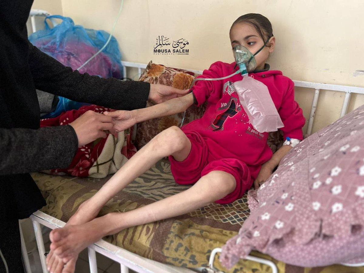 الطفلة نور الهدى في مستشفى كمال عدوان شمال غزة تعاني الجفاف وسوء التغذية في ظل استمرار حرب التجويع الإسرائيلية
#رمضان_14_الدعاء_المستجاب 
#انقذوا_سليمان 
#غزة_الآن 
#مستشفى_الشفاء
