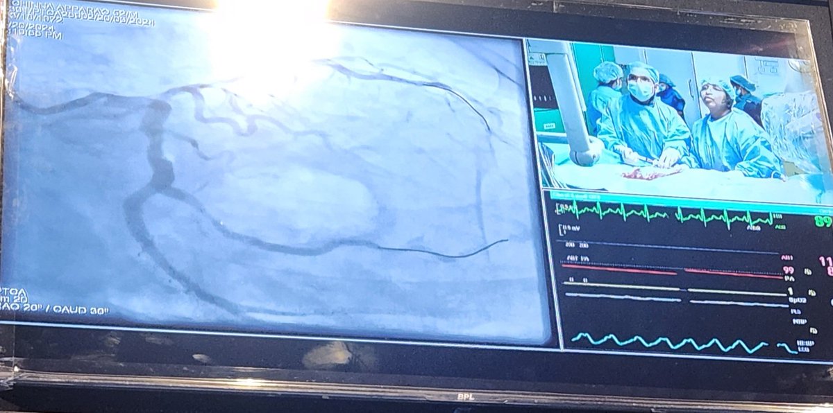 Excellent LIVE IN BOX Case of a LAD CTO by @Sujathavip at WCC 2024. @mmamas1973 @MadduryJ @APSIC6 @WomenAs1 @drsonyaburgess @mirvatalasnag @aayshacader @AMahilmaran @IJCDW_WINCARS