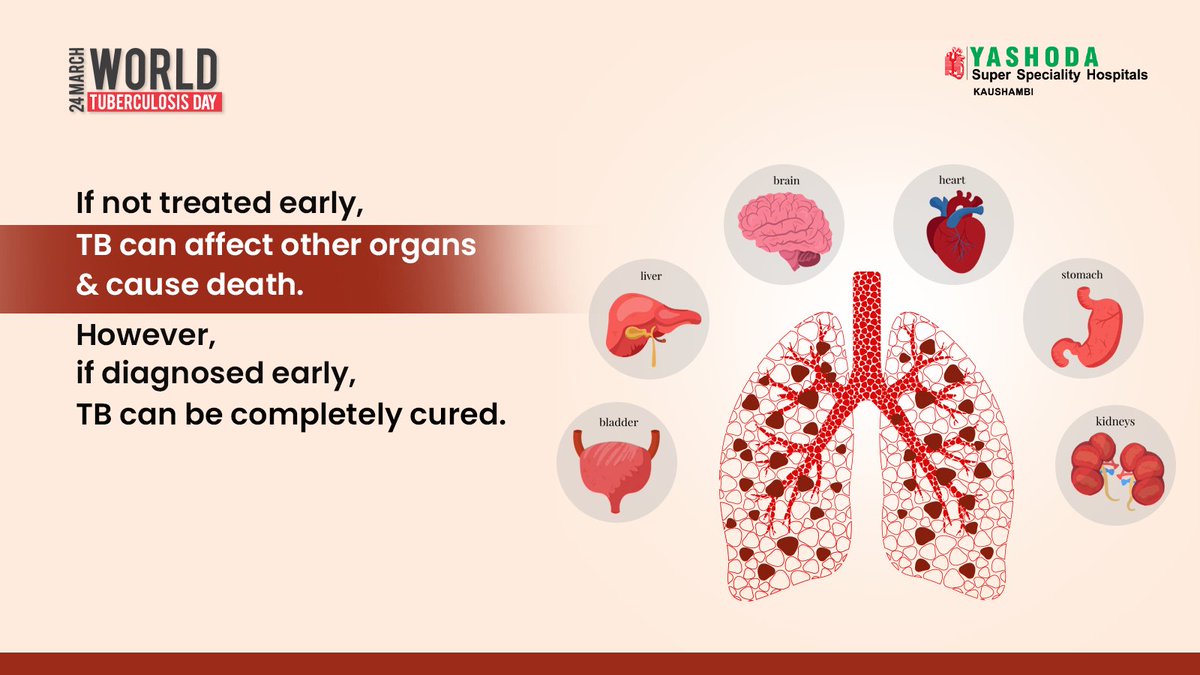 As a major step towards eradication of TB in Ghaziabad and nearby areas, we have pledged support to TB patients and launched STEPS! Raise awareness, urge early check-ups. Ensure your domestic help is informed. #WorldTuberculosisDay #EndTB #YashodaCares