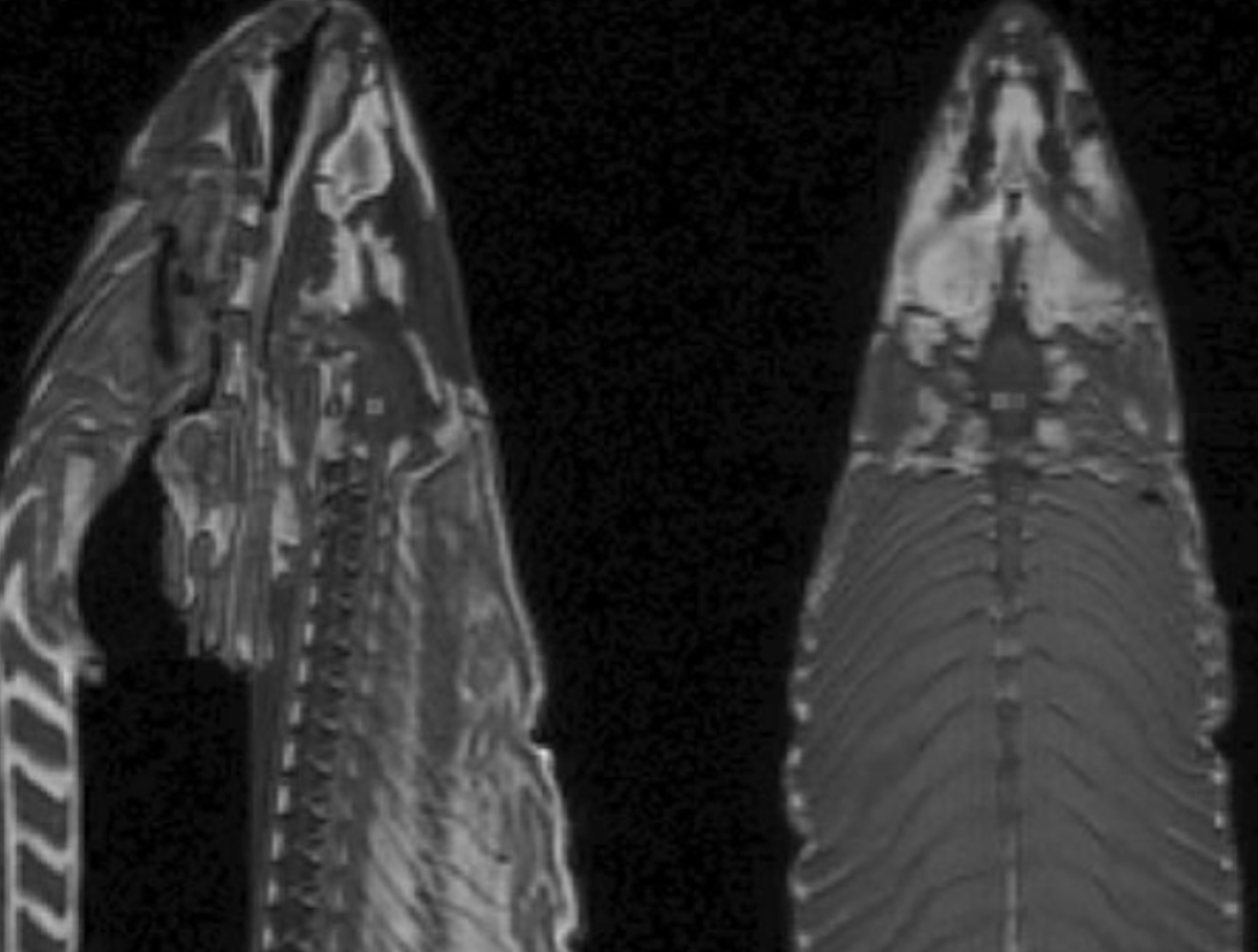 If you feed AI an MRI, it will happily write a detailed and very convincing diagnosis... even if the patient is a dead salmon.