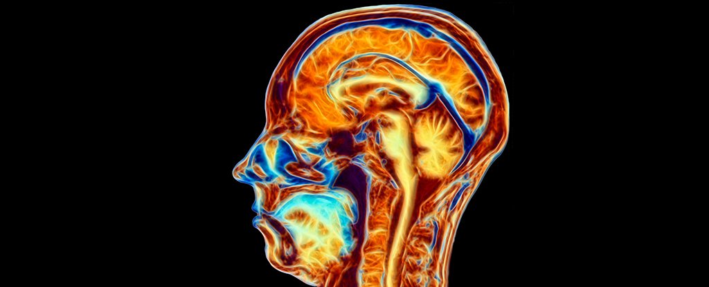 Your Blood Could Be Aging Your Brain, Increasing Risk of Dementia @yvonnemnolan @uccMedHealth sciencealert.com/your-blood-cou…