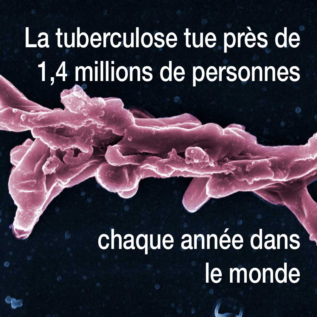 Journée mondiale contre la #Tuberculose 🧪🌐 Sensibilisons à l'importance de la recherche et de la prévention contre cette maladie qui touche des millions de personnes dans le monde. Tout comprendre sur la tuberculose avec notre fiche maladie ↘️ pasteur.fr/fr/centre-medi… #EndTB