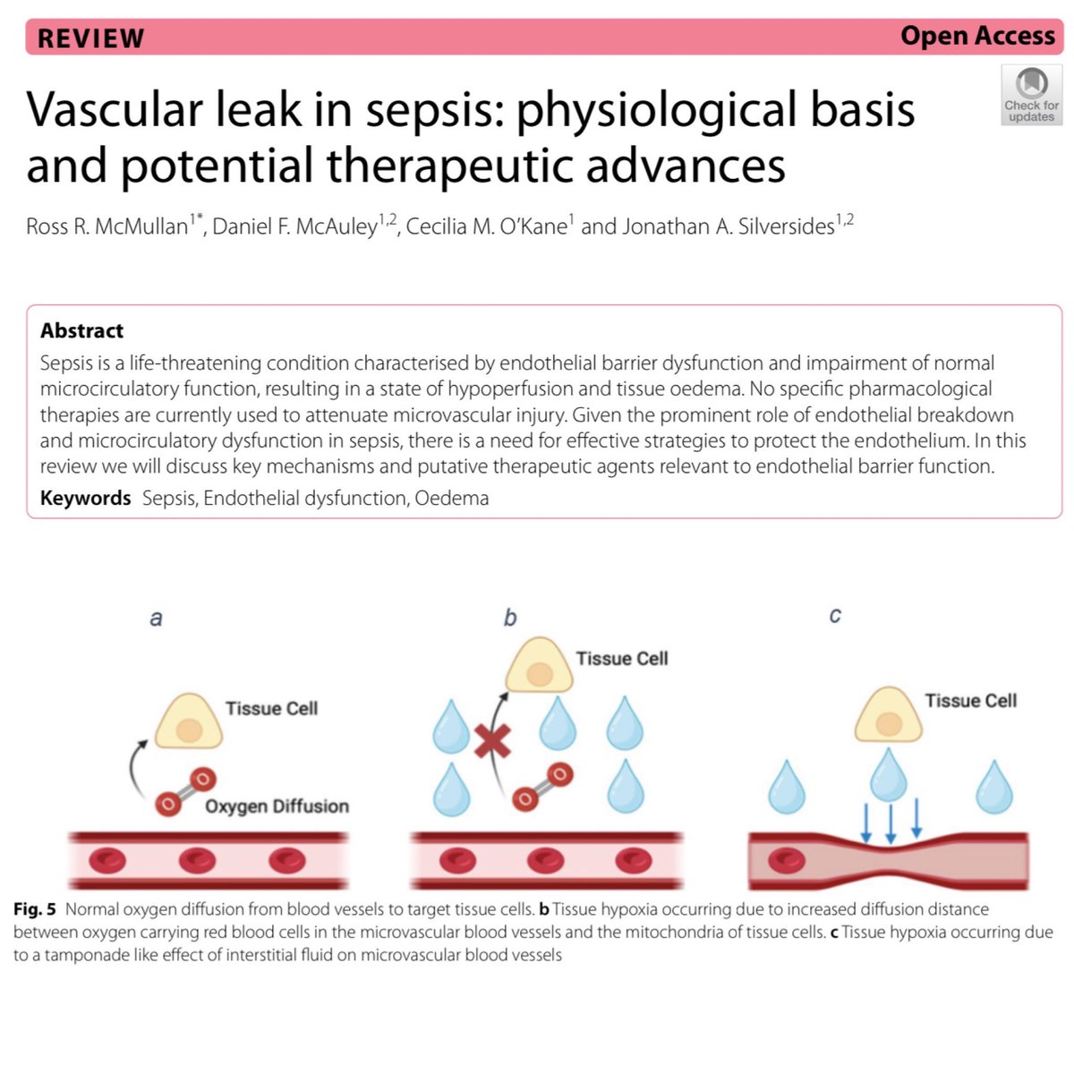 I love these vascular leak articles. Things get really nerdy really quick. This one also digs into therapeutic approaches to sort out the underlying issues. 🎩 tip to the authors. eddyjoemd.com/foamed/
