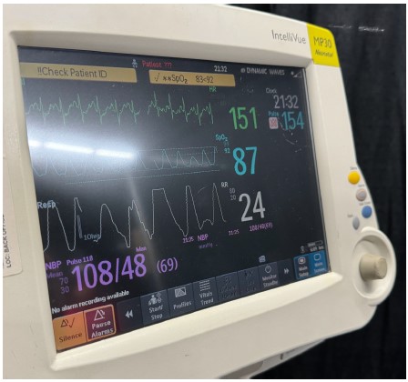 A 23yo woman at an electronic dance music festival had sudden onset of dyspnea, anxiety, & cyanosis.

@tayburkholder says she ingested a small bottle of liquid that others were inhaling. #whatsthediagnosis tinyurl.com/yzde7nzy #FOAMed