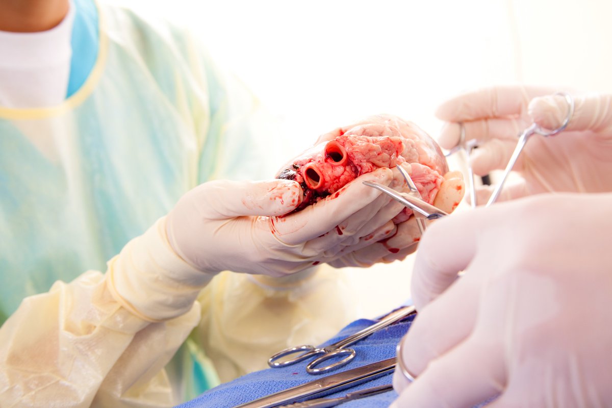 As a trainee, did you have access to open surgical opportunities? Explore the 'dying art' of open surgical training and its impact on specialties such as transplantation with @FDengu in the March #Bulletin: ow.ly/eKsp50QZNMW