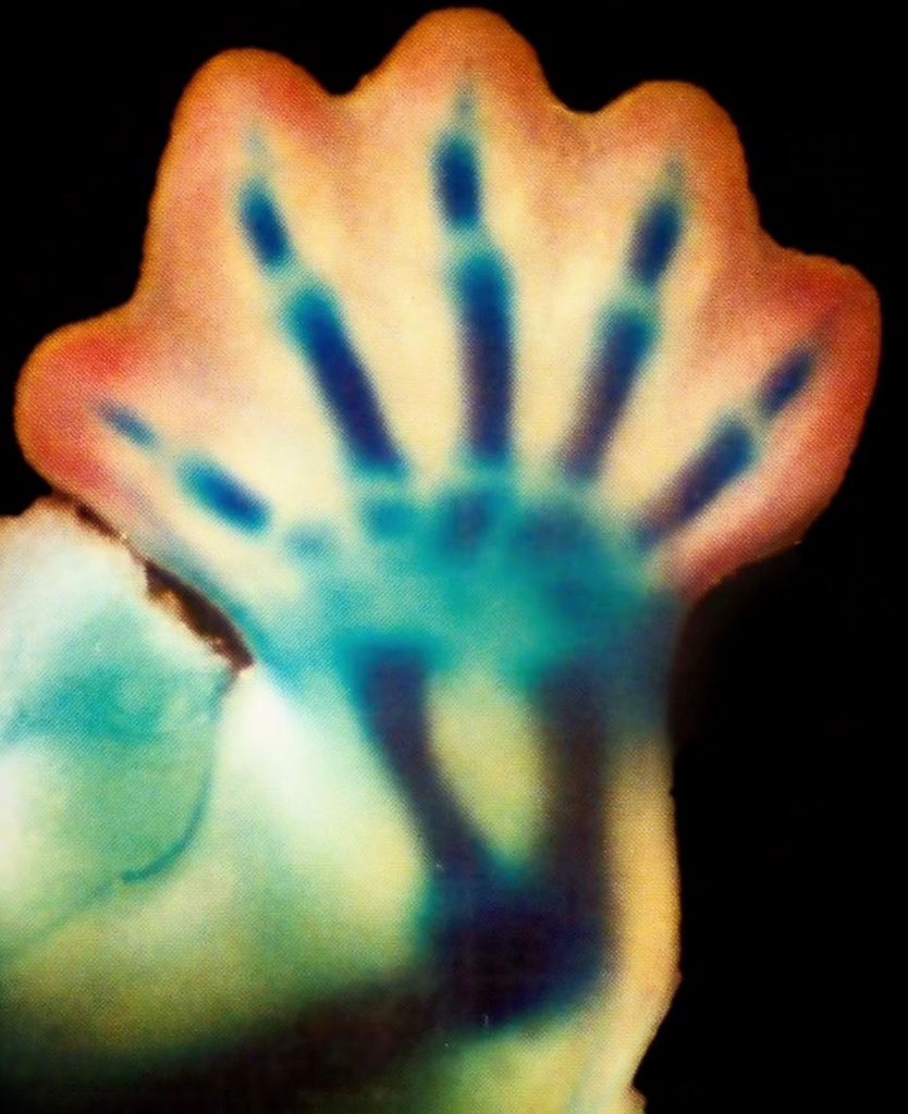 The skeletal hand of a 7-week-old embryo. What an amazing clump of cells. #human #HumanityFirst