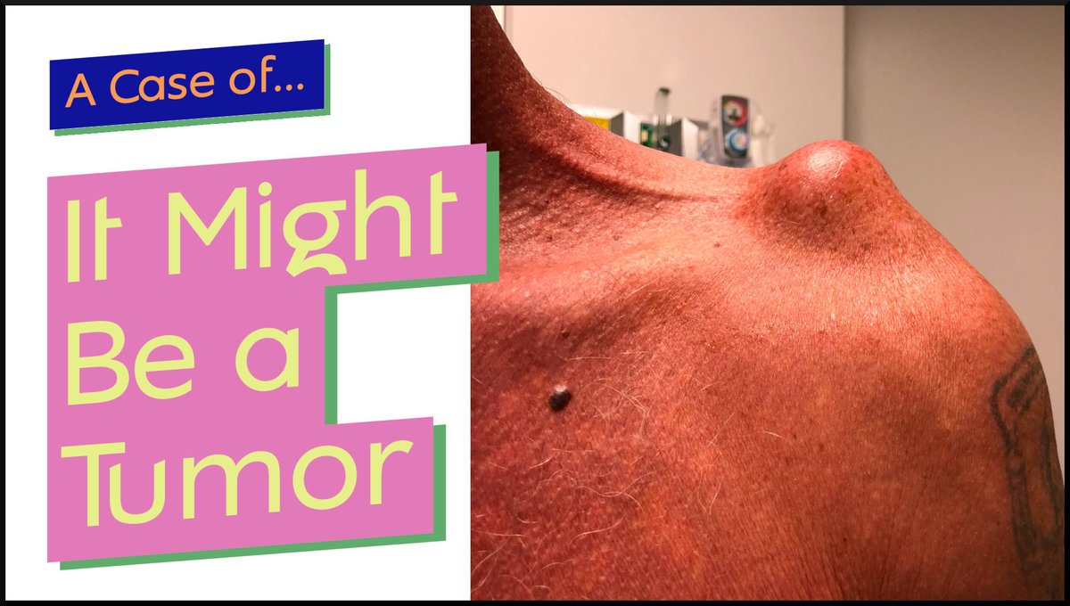 Check out the video version of our “it might be a tumor” case! Be sure to subscribe for future posts! youtube.com/watch?v=55e90O… #MedEd #MedicalEducation #Medicine #MedSchool #MedStudent #physicianassistant #nurse #doctor #nursepractitioner #paschool #medicalschool #palife