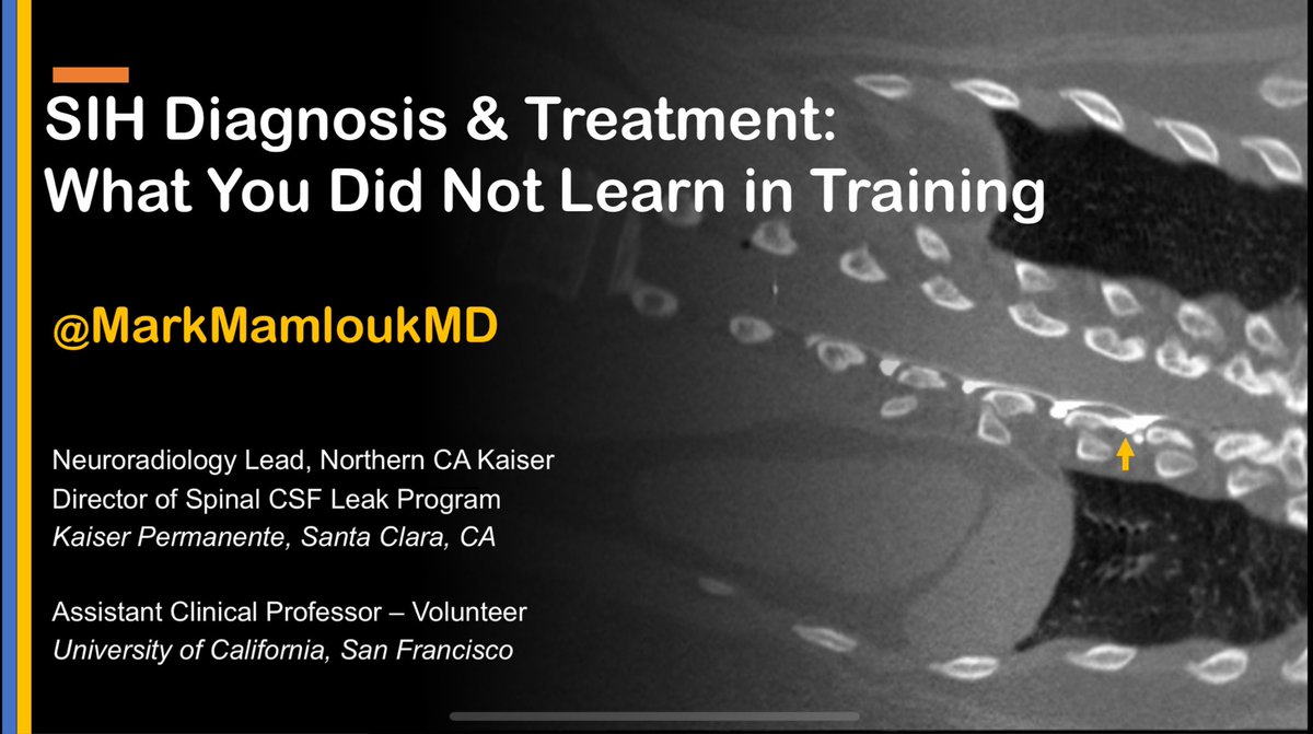 Honored to speak about the latest developments of #CSFleaks this morning at #SFNS2024 in this multidisciplinary society in beautiful Napa. @SFNeuro