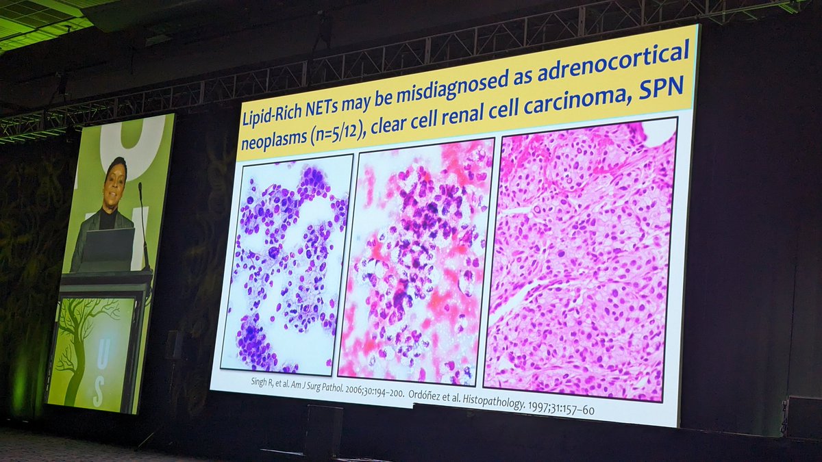 pbpath tweet picture