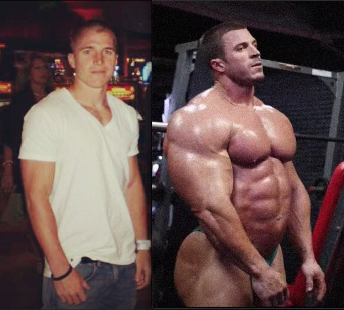 Brett Wilkin. From regular sized human to blown-up muscle freak complete with massive muscle tits and an obscene roid gut