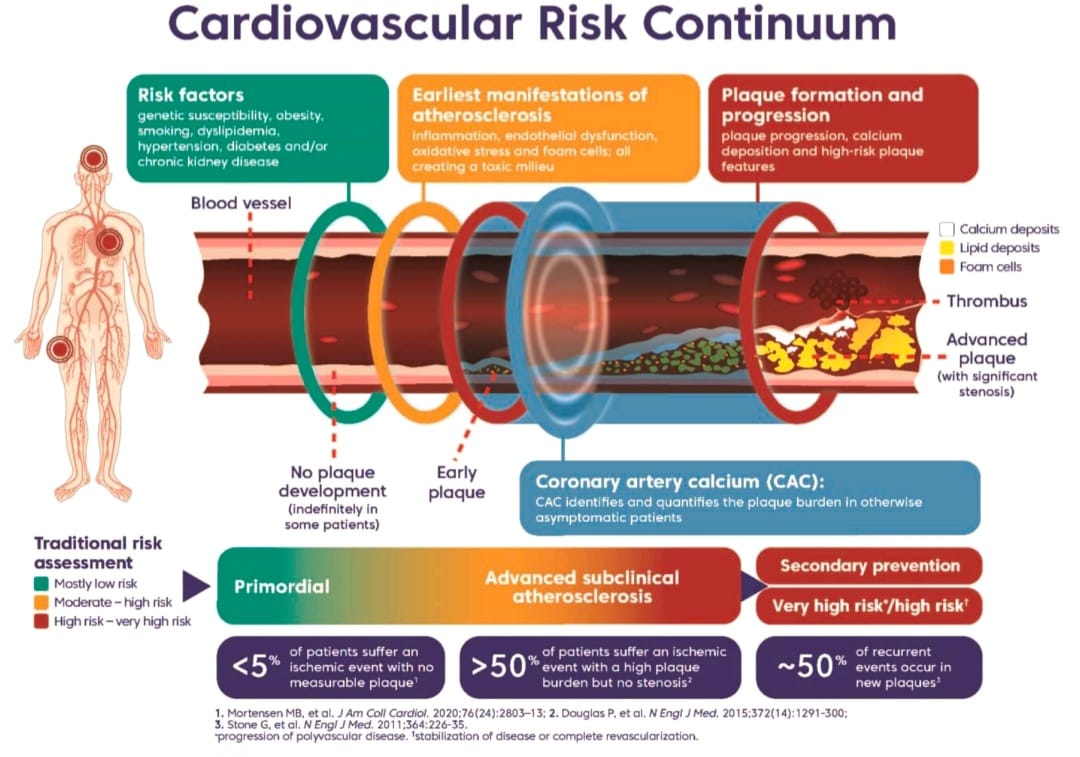 javier20ch's tweet photo. 📢Ateroesclerosis subclínica avanzada!! 🫀💥🧐
💬La fisiopatología de la Enf. Aterosclerótica es de naturaleza compleja y progresiva. Se desarrolla silenciosamente a lo largo de diferentes territorios vasculares mucho antes de que una estenosis alcance relevancia funcional o que ocurra un evento isquémico. 🫀💥📈
💬>50% de los eventos coronarios ocurren en 👥que antes no se consideraban de alto riesgo, que no tienen EAC obstructiva conocida y/o cuyas pruebas funcionales permanecen normales. 🤔🫀
💬Las calcificaciones (Ca-Score por AngioTC) de las arterias coronarias no son un proceso pasivo sino patognomónico de la evolución de la aterosclerosis coronaria. ✍️🧐
💬Es importante agregar a la dicotomía tradicional (prevención primaria y secundaria) un tercer espectro del continuo de la enfermedad CV ➡️"Aterosclerosis subclínica avanzada". 👨‍⚕️💊🫀

📚Ref:
https://t.co/7rSz39uDRT
⚡️Desc:
https://t.co/14GsWcEYs4