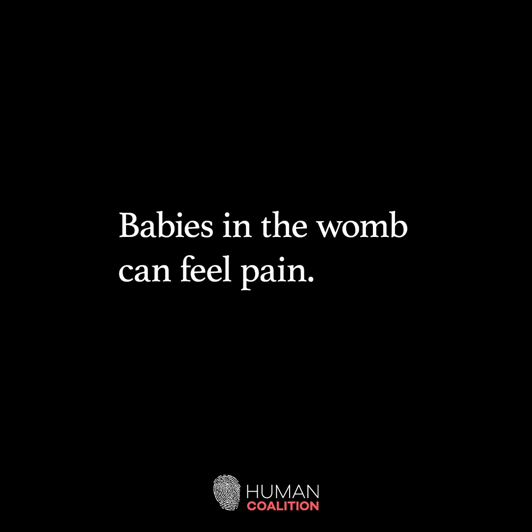 Preborn babies can feel pain. A study “Reconsidering Fetal Pain” confirms that babies in the womb can feel pain as early as 12 weeks old. #SaveTheBabyHumans #LifeIsAHumanRight #ValueLife #ChooseLife #EndAbortion #Abortion #ProLife #RescueThePreborn #HelpHurtingWomen