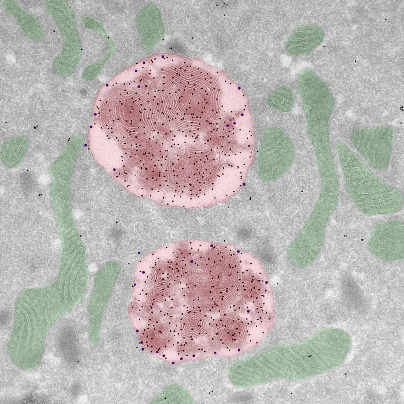 📆 May image of the month 'Roses' by Pekka Kujala, UMC Utrecht (@UMCUtrecht).

🌹Explore rosette-like, swirled membranes of late endosomes (red) in Drosophila midgut. 

🔬 Imaged with a JEOL 1010 #TEM (@JEOLEUROPE) at the Cell Microscopy Core, UMC Utrecht (@UMCUtrecht)