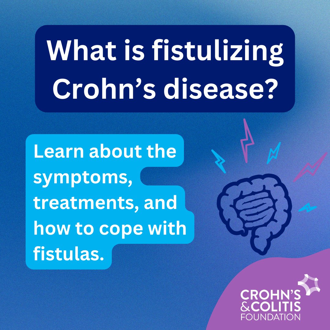 Many IBD patients, especially those with Crohn’s disease, may develop a fistula at some point in their disease journey. Learn about the signs and symptoms of fistulizing Crohn's disease and how IBD patients are living and coping with this complication: bit.ly/49AyYqt
