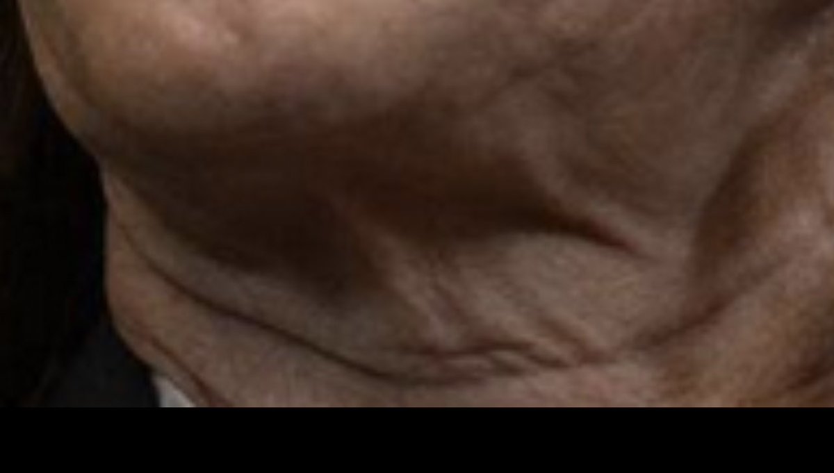 Bertrand SCHOLLER tweet media