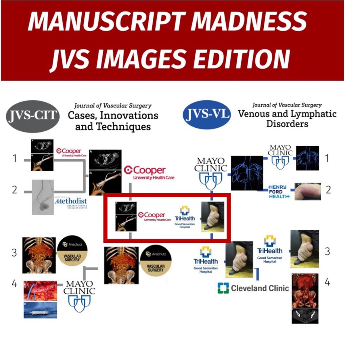 #VascTwitter has spoken and the #ManuscriptMadness finalists are here!! <a href="/CooperVascular/">Cooper Vascular Surgery Residency</a> <a href="/VascSurgMD/">Joseph V. Lombardi MD MBA</a> <a href="/KatMcMack/">Katherine McMackin</a> <a href="/AshleyAmunds/">Ashley Amundson, MD</a> <a href="/patrickmuckmd/">@PatrickMuckMD</a> <a href="/TriHealthVasc/">TriHealth Vascular Surgery</a> May the odds be ever in ur favor and may the best journal
win!! <a href="/ProleneQueen/">Meryl Simon Logan, MD</a> <a href="/VascularSVS/">Vascular SVS</a> <a href="/mattsmeds/">Matthew Smeds</a> <a href="/limbsalvagedr/">Leigh Ann O'Banion</a> <a href="/JVSVL/">JVS - Venous and Lymphatic Disorders</a>