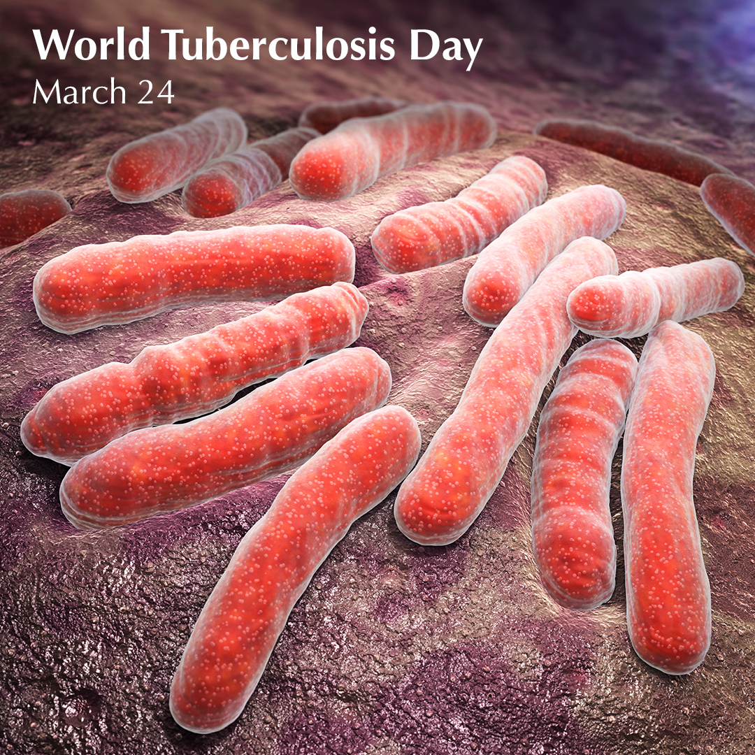 WrldwideLifeSci's tweet photo. Today is Tuberculosis Day. Talk to your patients about Tuberculosis testing to help end the disease.

#TB #TuberculosisDay #WorldTuberculosisDay #WorldTBDay #TuberculosisDay https://t.co/lxxwDiHiA6